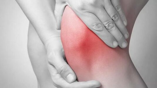 a térdízület arthrosisa